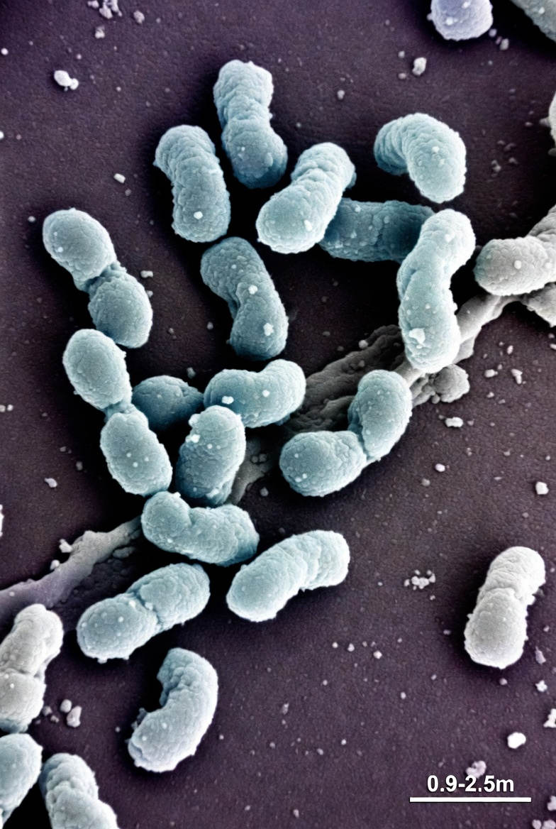 Acinetobacter baumannii foi classificada pela OMS em 2024 como uma das bactérias mais perigosas do mundo