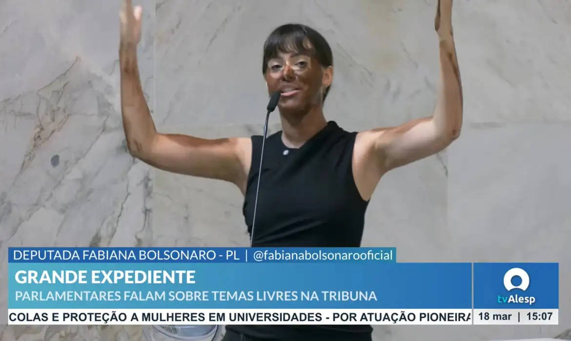 Blackface praticada pela deputada Fabiana Bolsonaro é considerada prática racista