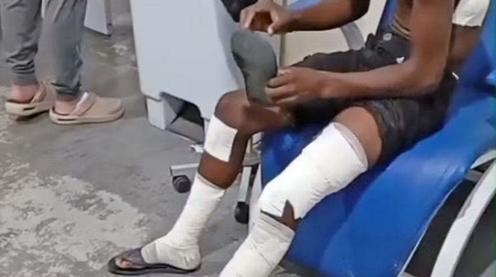 Vítimas sofreram ferimentos considerados sem gravidade 